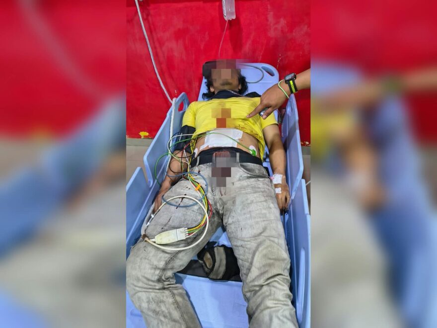Antar Pesanan Makanan, Pria di Martapura Ditusuk Badik hingga Perut Terluka